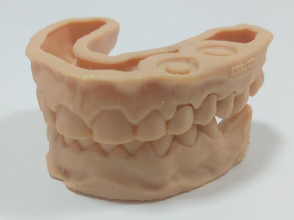 3D Printing Limburg | https://www.3dprintinglimburg.nl/files/afbeeldingen/portfolio/Dental1 Cropped.jpg